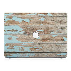 This lightweight, slim hardshell with Wood design is easy to install and fits closely to protect against scratches