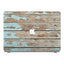 Macbook Premium Case - Wood