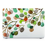 This lightweight, slim hardshell with Leaves design is easy to install and fits closely to protect against scratches