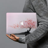 hardshell case with Love design combines a sleek hardshell design with vibrant colors for stylish protection against scratches, dents, and bumps for your Macbook